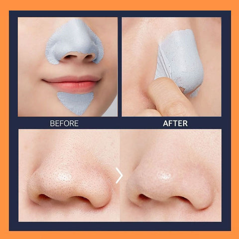 APIEU Goblin Peel Off Nose Pack 50ml APIEU